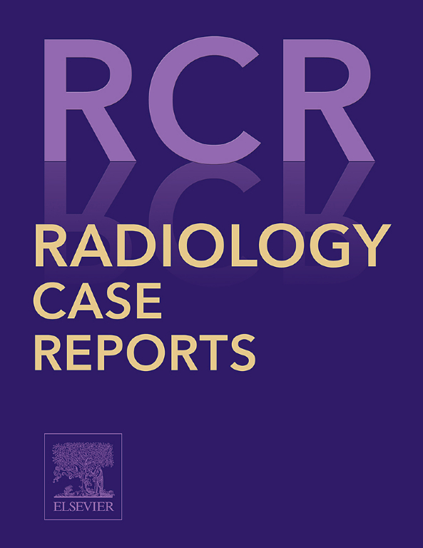 Go to journal home page - Radiology Case Reports